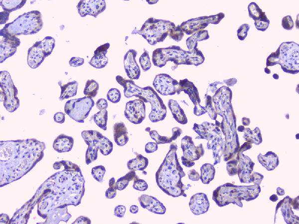 IHC analysis of PTP1B using anti-PTP1B antibody (A00613-1). PTP1B was detected in paraffin-embedded section of human placenta tissues. Heat mediated antigen retrieval was performed in citrate buffer (pH6, epitope retrieval solution) for 20 mins. The tissue section was blocked with 10% goat serum. The tissue section was then incubated with 1μg/ml rabbit anti-PTP1B Antibody (A00613-1) overnight at 4°C. Biotinylated goat anti-rabbit IgG was used as secondary antibody and incubated for 30 minutes at 37°C. The tissue section was developed using Strepavidin-Biotin-Complex (SABC)(Catalog # SA1022) with DAB as the chromogen.