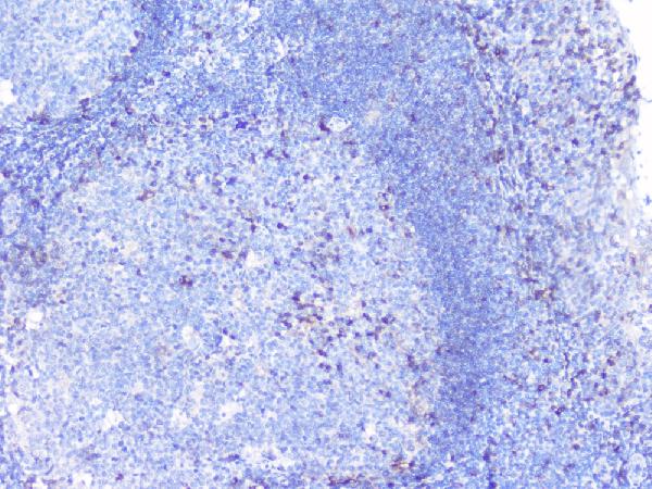 IHC analysis of PTP1B using anti-PTP1B antibody (A00613-1). PTP1B was detected in paraffin-embedded section of human tonsil tissues. Heat mediated antigen retrieval was performed in citrate buffer (pH6, epitope retrieval solution) for 20 mins. The tissue section was blocked with 10% goat serum. The tissue section was then incubated with 1μg/ml rabbit anti-PTP1B Antibody (A00613-1) overnight at 4°C. Biotinylated goat anti-rabbit IgG was used as secondary antibody and incubated for 30 minutes at 37°C. The tissue section was developed using Strepavidin-Biotin-Complex (SABC)(Catalog # SA1022) with DAB as the chromogen.