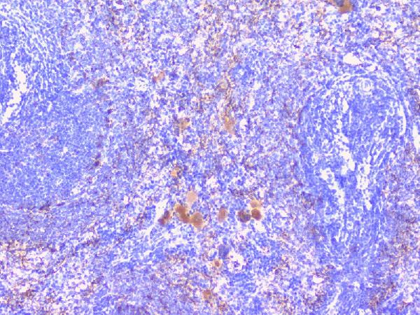 IHC analysis of PTP1B using anti-PTP1B antibody (A00613-1). PTP1B was detected in paraffin-embedded section of rat spleen tissues. Heat mediated antigen retrieval was performed in citrate buffer (pH6, epitope retrieval solution) for 20 mins. The tissue section was blocked with 10% goat serum. The tissue section was then incubated with 1μg/ml rabbit anti-PTP1B Antibody (A00613-1) overnight at 4°C. Biotinylated goat anti-rabbit IgG was used as secondary antibody and incubated for 30 minutes at 37°C. The tissue section was developed using Strepavidin-Biotin-Complex (SABC)(Catalog # SA1022) with DAB as the chromogen.