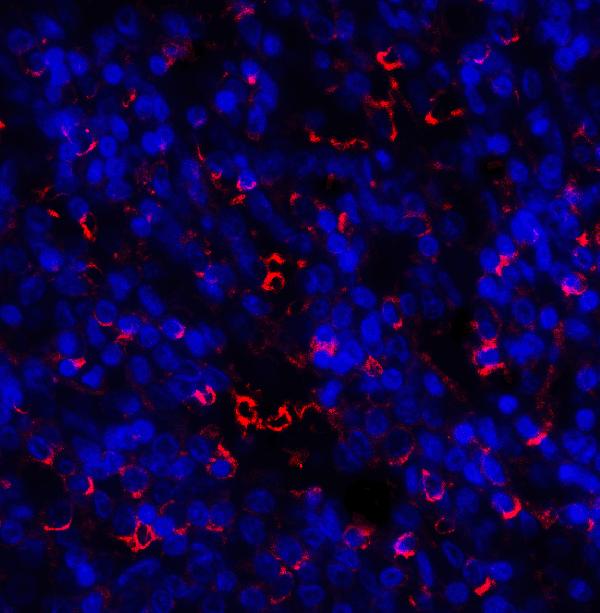 Anti-TIM-3 HAVCR2 Antibody