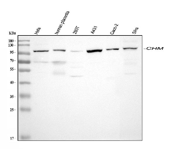 Western blot analysis of CHM using anti-CHM antibody (A00814-2).