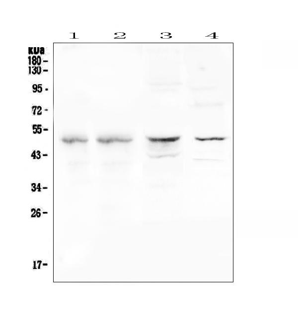 Western blot analysis of CFP using anti-CFP antibody (A00852-2). Electrophoresis was performed on a 5-20% SDS-PAGE gel at 70V (Stacking gel) / 90V (Resolving gel) for 2-3 hours. The sample well of each lane was loaded with 50ug of sample under reducing conditions. Lane 1: human placenta tissue lysates, Lane 2: human U-937 whole cell lysate, Lane 3: rat brain tissue lysates, Lane 4: mouse brain tissue lysates. After Electrophoresis, proteins were transferred to a Nitrocellulose membrane at 150mA for 50-90 minutes. Blocked the membrane with 5% Non-fat Milk/ TBS for 1.5 hour at RT. The membrane was incubated with rabbit anti-CFP antigen affinity purified polyclonal antibody (Catalog # A00852-2) at 0.5 μg/mL overnight at 4°C, then washed with TBS-0.1%Tween 3 times with 5 minutes each and probed with a goat anti-rabbit IgG-HRP secondary antibody at a dilution of 1:10000 for 1.5 hour at RT. The signal is developed using an Enhanced Chemiluminescent detection (ECL) kit (Catalog # EK1002) with Tanon 5200 system. A specific band was detected for CFP at approximately 51KD. The expected band size for CFP is at 51KD.