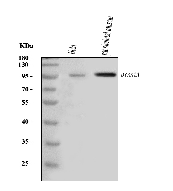 Western blot analysis of DYRK1A using anti-DYRK1A antibody (A00878-1).