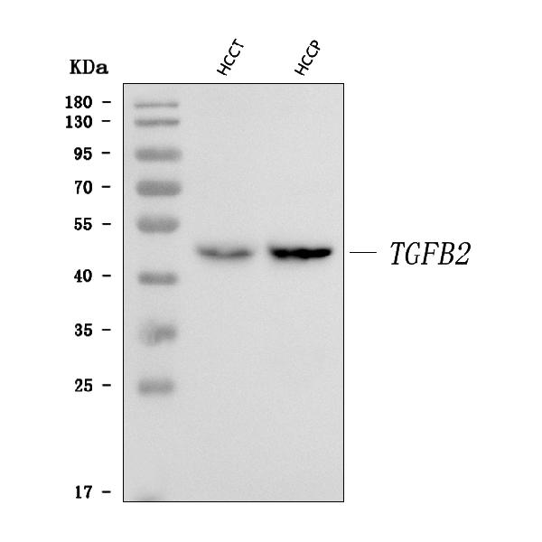 Western blot analysis of TGF beta 2 using anti-TGF beta 2 antibody (A00892-1).