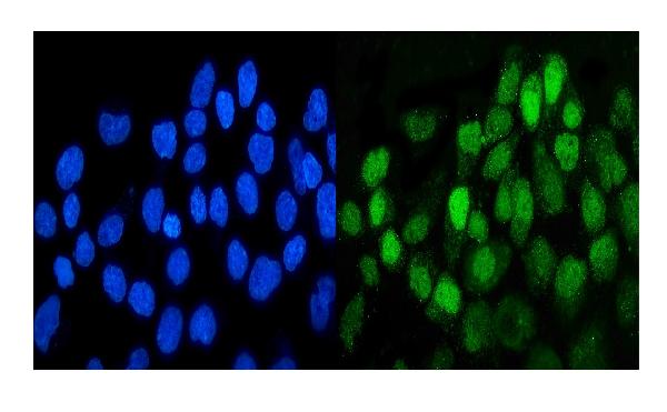 IF analysis of DDR1 using anti-DDR1 antibody (A00905).