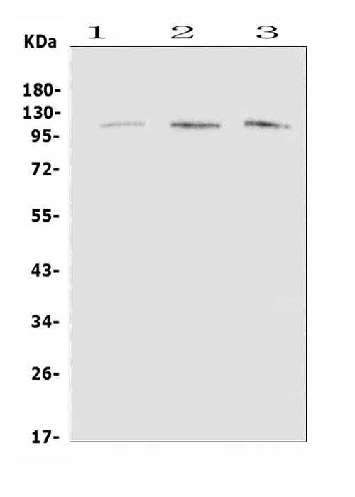 Western blot analysis of EML4 using anti-EML4 antibody (A00930-1). Electrophoresis was performed on a 5-20% SDS-PAGE gel at 70V (Stacking gel) / 90V (Resolving gel) for 2-3 hours. The sample well of each lane was loaded with 50ug of sample under reducing conditions. Lane 1: rat brain tissue lysates, Lane 2: mouse brain tissue lysates, Lane 3: mouse lung tissue lysates. After Electrophoresis, proteins were transferred to a Nitrocellulose membrane at 150mA for 50-90 minutes. Blocked the membrane with 5% Non-fat Milk/ TBS for 1.5 hour at RT. The membrane was incubated with rabbit anti-EML4 antigen affinity purified polyclonal antibody (Catalog # A00930-1) at 0.5 μg/mL overnight at 4°C, then washed with TBS-0.1%Tween 3 times with 5 minutes each and probed with a goat anti-rabbit IgG-HRP secondary antibody at a dilution of 1:10000 for 1.5 hour at RT. The signal is developed using an Enhanced Chemiluminescent detection (ECL) kit (Catalog # EK1002) with Tanon 5200 system. A specific band was detected for EML4 at approximately 120KD. The expected band size for EML4 is at 109KD.