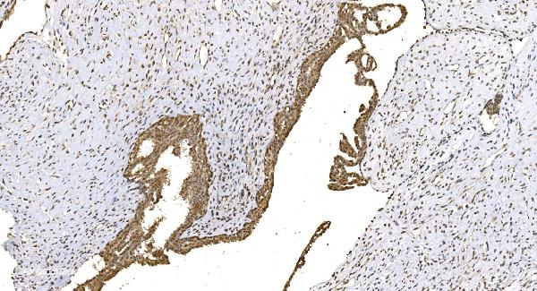 IHC analysis of WEE1 using anti-WEE1 antibody (A01319-1).