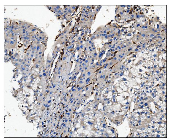 IHC analysis of CD16 using anti-CD16 antibody (A01408-1).