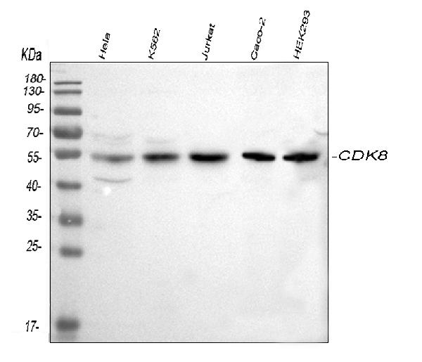 Western blot analysis of CDK8 using anti-CDK8 antibody (A01493-1).