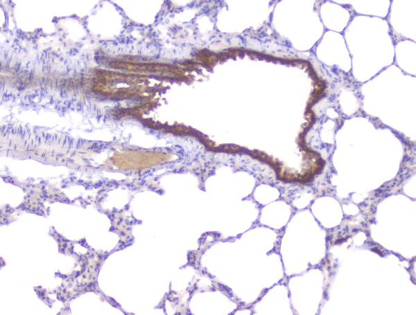 IHC analysis of PKC beta 1 using anti-PKC beta 1 antibody (A01940). PKC beta 1 was detected in paraffin-embedded section of rat lung tissues. Heat mediated antigen retrieval was performed in citrate buffer (pH6, epitope retrieval solution) for 20 mins. The tissue section was blocked with 10% goat serum. The tissue section was then incubated with 1μg/ml rabbit anti-PKC beta 1 Antibody (A01940) overnight at 4°C. Biotinylated goat anti-rabbit IgG was used as secondary antibody and incubated for 30 minutes at 37°C. The tissue section was developed using Strepavidin-Biotin-Complex (SABC)(Catalog # SA1022) with DAB as the chromogen.
