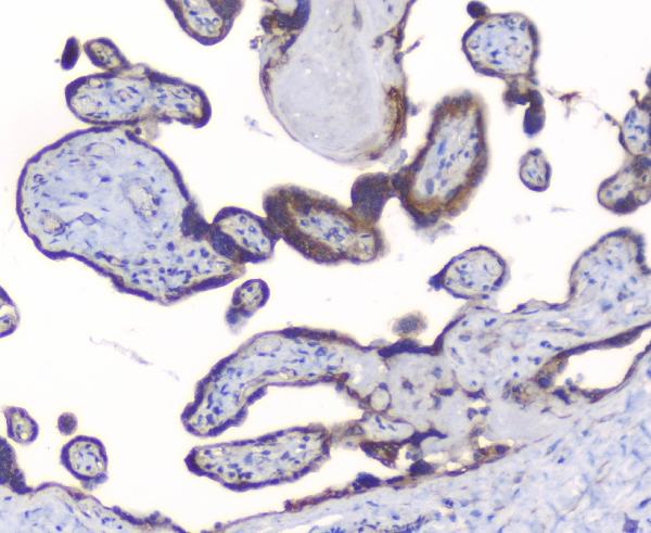 IHC analysis of PKC beta 1 using anti-PKC beta 1 antibody (A01940). PKC beta 1 was detected in paraffin-embedded section of human placenta tissues. Heat mediated antigen retrieval was performed in citrate buffer (pH6, epitope retrieval solution) for 20 mins. The tissue section was blocked with 10% goat serum. The tissue section was then incubated with 1μg/ml rabbit anti-PKC beta 1 Antibody (A01940) overnight at 4°C. Biotinylated goat anti-rabbit IgG was used as secondary antibody and incubated for 30 minutes at 37°C. The tissue section was developed using Strepavidin-Biotin-Complex (SABC)(Catalog # SA1022) with DAB as the chromogen.