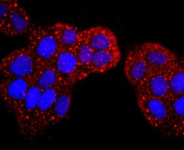 Protein S100-P S100P Antibody A01963-1