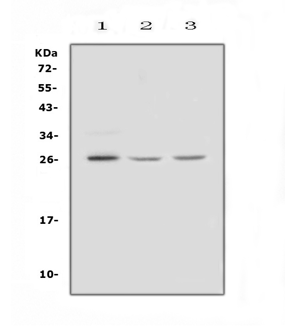 Western blot analysis of FGF9 using anti-FGF9 antibody (A02274). Electrophoresis was performed on a 5-20% SDS-PAGE gel at 70V (Stacking gel) / 90V (Resolving gel) for 2-3 hours. The sample well of each lane was loaded with 50ug of sample under reducing conditions. Lane 1: human COLO-320 whole cell lysates, Lane 2: rat brain tissue lysates, Lane 3: mouse brain tissue lysates. After Electrophoresis, proteins were transferred to a Nitrocellulose membrane at 150mA for 50-90 minutes. Blocked the membrane with 5% Non-fat Milk/ TBS for 1.5 hour at RT. The membrane was incubated with rabbit anti-FGF9 antigen affinity purified polyclonal antibody (Catalog # A02274) at 0.5 μg/mL overnight at 4°C, then washed with TBS-0.1%Tween 3 times with 5 minutes each and probed with a goat anti-rabbit IgG-HRP secondary antibody at a dilution of 1:10000 for 1.5 hour at RT. The signal is developed using an Enhanced Chemiluminescent detection (ECL) kit (Catalog # EK1002) with Tanon 5200 system. A specific band was detected for FGF9 at approximately 26KD. The expected band size for FGF9 is at 23KD.