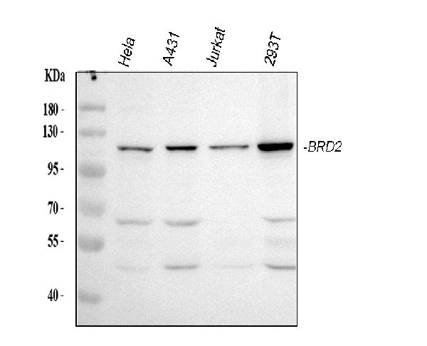 Western blots show p65 antibodies that passed the test of specificity