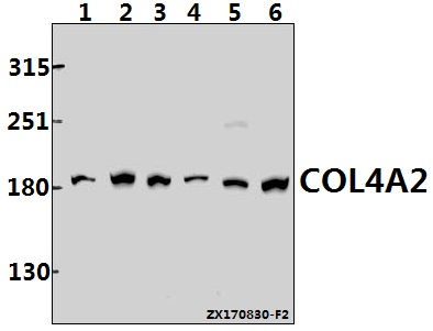 a02453 col4a2 primary antibodies wb testing 1