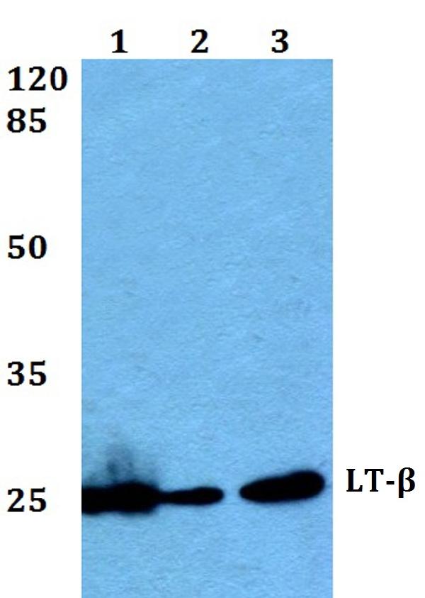 Anti Lt Beta V211 Ltb Antibody