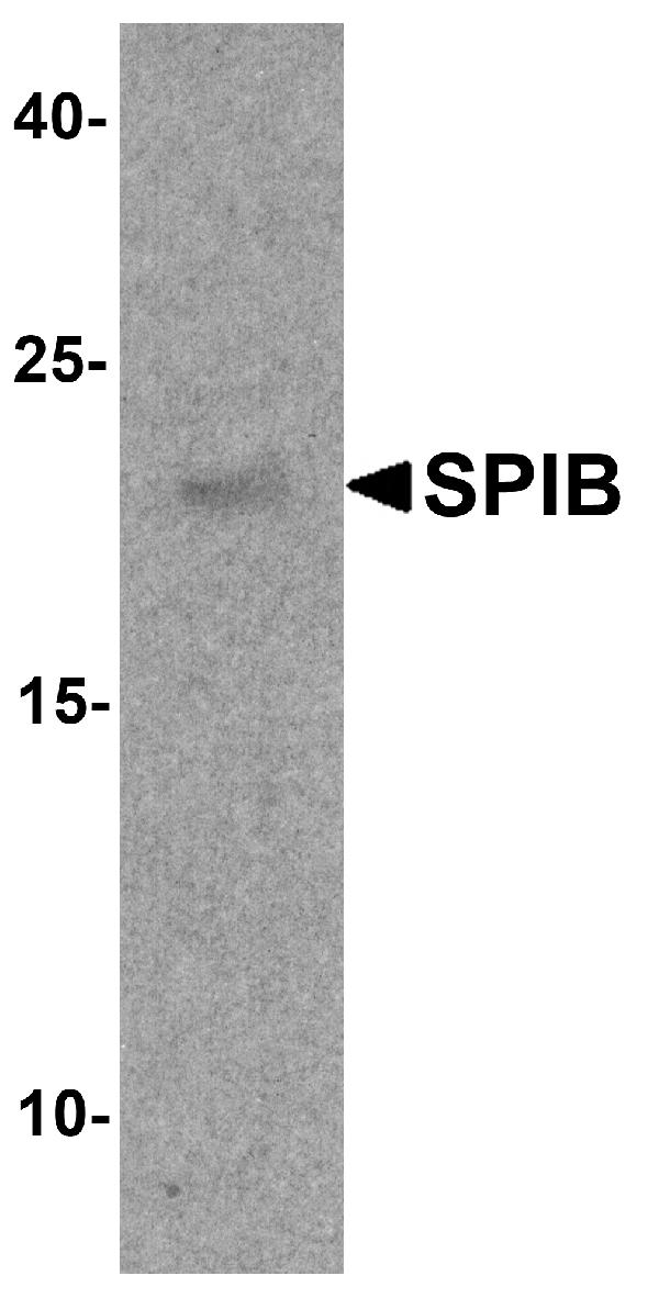 Transcription Factor Spi-B SPIB Antibody