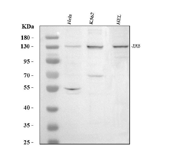 Western blot analysis of Exportin-5/XPO5 using anti-Exportin-5/XPO5 antibody (A02900).