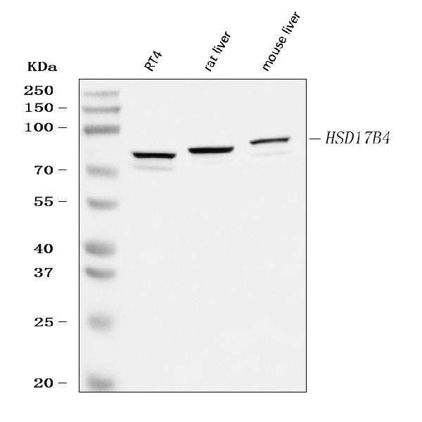 Western blot analysis of HSD17B4 using anti-HSD17B4 antibody (A02923).