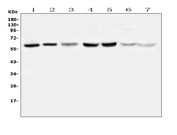 Western blot analysis of PLAT using anti-PLAT antibody (A02965-1). Electrophoresis was performed on a 5-20% SDS-PAGE gel at 70V (Stacking gel) / 90V (Resolving gel) for 2-3 hours. The sample well of each lane was loaded with 50ug of sample under reducing conditions. Lane 1: human Hela whole cell lysates, Lane 2: human U2OS whole cell lysates, Lane 3: human U-87MG whole cell lysates, Lane 4: rat liver tissue lysates, Lane 5: rat kidney tissue lysates, Lane 6: mouse liver tissue lysates, Lane 7: mouse kidney tissue lysates. After Electrophoresis, proteins were transferred to a Nitrocellulose membrane at 150mA for 50-90 minutes. Blocked the membrane with 5% Non-fat Milk/ TBS for 1.5 hour at RT. The membrane was incubated with rabbit anti-PLAT antigen affinity purified polyclonal antibody (Catalog # A02965-1) at 0.5 μg/mL overnight at 4°C, then washed with TBS-0.1%Tween 3 times with 5 minutes each and probed with a goat anti-rabbit IgG-HRP secondary antibody at a dilution of 1:10000 for 1.5 hour at RT. The signal is developed using an Enhanced Chemiluminescent detection (ECL) kit (Catalog # EK1002) with Tanon 5200 system. A specific band was detected for PLAT at approximately 63-69KD. The expected band size for PLAT is at 63KD.