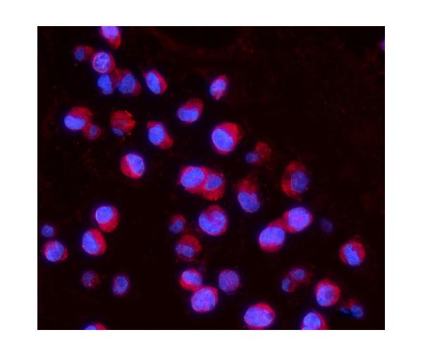 IF analysis of IL15RA using anti-IL15RA antibody (A03016-1).