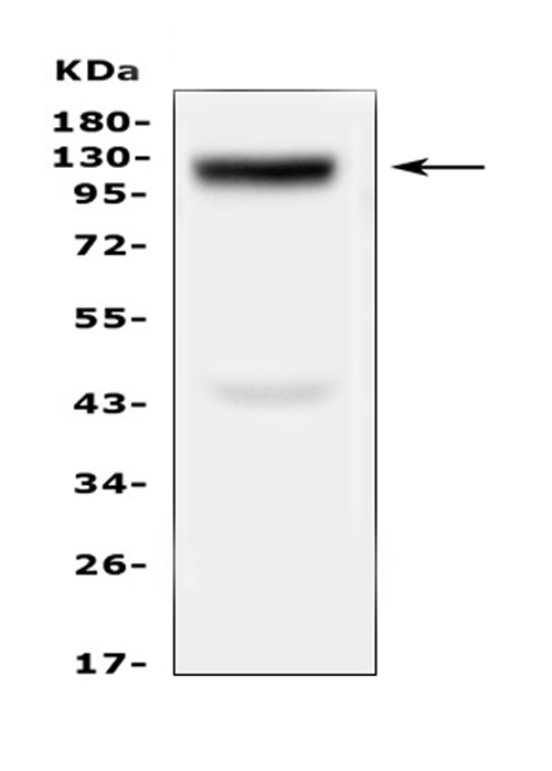 Western blot analysis of COL17A1 using anti-COL17A1 antibody (A03031-1). Electrophoresis was performed on a 5-20% SDS-PAGE gel at 70V (Stacking gel) / 90V (Resolving gel) for 2-3 hours. The sample well of each lane was loaded with 50ug of sample under reducing conditions. Lane 1: human Hela whole cell lysates. After Electrophoresis, proteins were transferred to a Nitrocellulose membrane at 150mA for 50-90 minutes. Blocked the membrane with 5% Non-fat Milk/ TBS for 1.5 hour at RT. The membrane was incubated with rabbit anti-COL17A1 antigen affinity purified polyclonal antibody (Catalog # A03031-1) at 0.5 μg/mL overnight at 4°C, then washed with TBS-0.1%Tween 3 times with 5 minutes each and probed with a goat anti-rabbit IgG-HRP secondary antibody at a dilution of 1:10000 for 1.5 hour at RT. The signal is developed using an Enhanced Chemiluminescent detection (ECL) kit (Catalog # EK1002) with Tanon 5200 system. A specific band was detected for COL17A1 at approximately 125KD. The expected band size for COL17A1 is at 150KD.