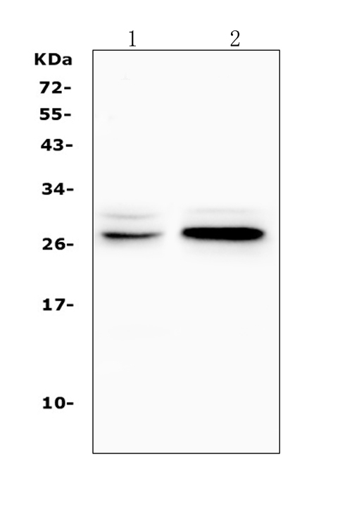 Western blot analysis of TNFRSF18 using anti-TNFRSF18 antibody (A03125-1). Electrophoresis was performed on a 5-20% SDS-PAGE gel at 70V (Stacking gel) / 90V (Resolving gel) for 2-3 hours. The sample well of each lane was loaded with 50ug of sample under reducing conditions. Lane 1: rat kidney tissue lysate, Lane 2: mouse kidney tissue lysate. After Electrophoresis, proteins were transferred to a Nitrocellulose membrane at 150mA for 50-90 minutes. Blocked the membrane with 5% Non-fat Milk/ TBS for 1.5 hour at RT. The membrane was incubated with rabbit anti-TNFRSF18 antigen affinity purified polyclonal antibody (Catalog # A03125-1) at 0.5 μg/mL overnight at 4°C, then washed with TBS-0.1%Tween 3 times with 5 minutes each and probed with a goat anti-rabbit IgG-HRP secondary antibody at a dilution of 1:10000 for 1.5 hour at RT. The signal is developed using an Enhanced Chemiluminescent detection (ECL) kit (Catalog # EK1002) with Tanon 5200 system. A specific band was detected for TNFRSF18 at approximately 28KD. The expected band size for TNFRSF18 is at 26KD.