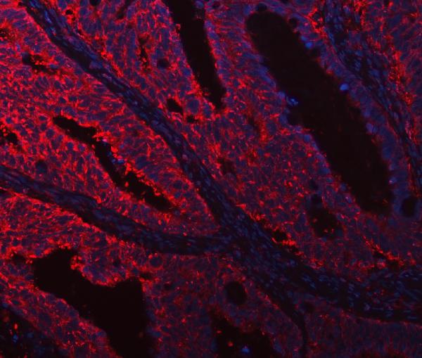 DOCK180/DOCK1 Antibody