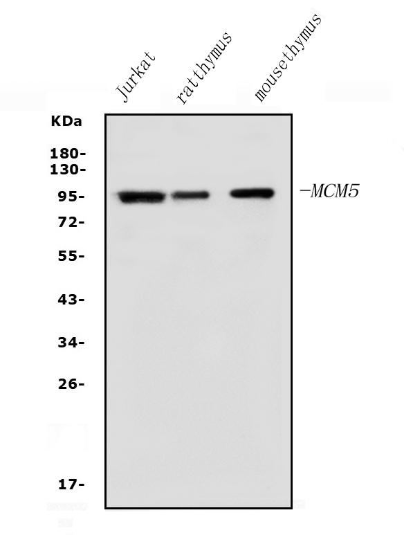 Western blot analysis of MCM5 using anti-MCM5 antibody (A03642).