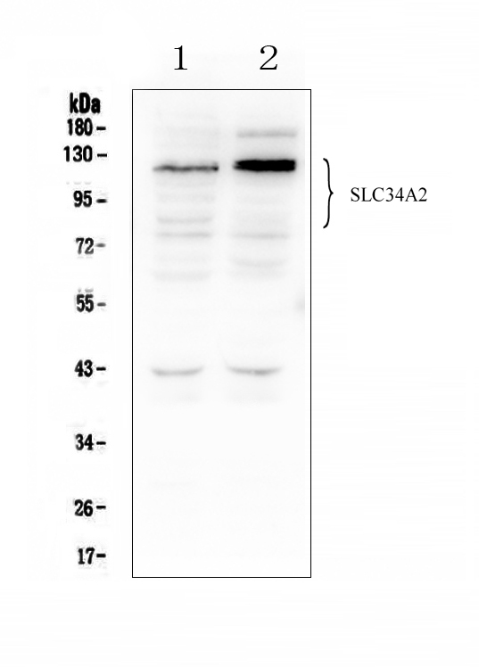 Western blot analysis of SLC34A2 using anti-SLC34A2 antibody (A03957-1). Electrophoresis was performed on a 5-20% SDS-PAGE gel at 70V (Stacking gel) / 90V (Resolving gel) for 2-3 hours. The sample well of each lane was loaded with 50ug of sample under reducing conditions. Lane 1: human HEK293 whole cell lysates, Lane 2: human K562 whole cell lysates. After Electrophoresis, proteins were transferred to a Nitrocellulose membrane at 150mA for 50-90 minutes. Blocked the membrane with 5% Non-fat Milk/ TBS for 1.5 hour at RT. The membrane was incubated with rabbit anti-SLC34A2 antigen affinity purified polyclonal antibody (Catalog # A03957-1) at 0.5 μg/mL overnight at 4°C, then washed with TBS-0.1%Tween 3 times with 5 minutes each and probed with a goat anti-rabbit IgG-HRP secondary antibody at a dilution of 1:10000 for 1.5 hour at RT. The signal is developed using an Enhanced Chemiluminescent detection (ECL) kit (Catalog # EK1002) with Tanon 5200 system. A specific band was detected for SLC34A2 at approximately 76-130KD. The expected band size for SLC34A2 is at 76KD.