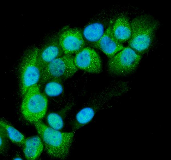 IF analysis of RAB11B using anti-RAB11B antibody (A04526-1). RAB11B was detected in immunocytochemical section of A431 cells. Enzyme antigen retrieval was performed using IHC enzyme antigen retrieval reagent (AR0022) for 15 mins. The cells were blocked with 10% goat serum. And then incubated with 2μg/mL rabbit anti-RAB11B Antibody (A04526-1) overnight at 4°C. DyLight®488 Conjugated Goat Anti-Rabbit IgG (BA1127) was used as secondary antibody at 1:100 dilution and incubated for 30 minutes at 37°C. The section was counterstained with DAPI. Visualize using a fluorescence microscope and filter sets appropriate for the label used.