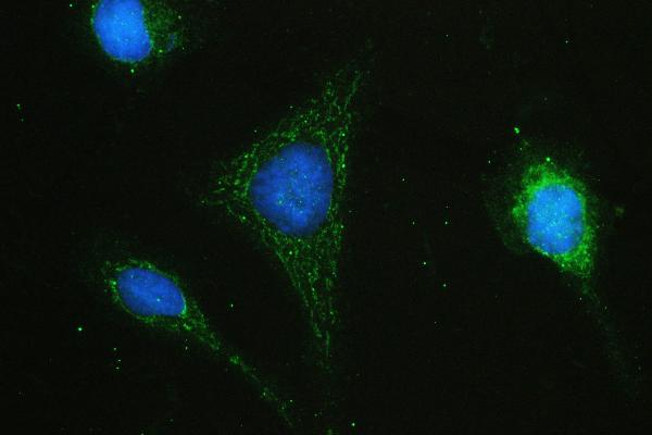 IF analysis of HAS1 using anti-HAS1 antibody (A04784-1). HAS1 was detected in immunocytochemical section of U20S cell. Enzyme antigen retrieval was performed using IHC enzyme antigen retrieval reagent (AR0022) for 15 mins. The cells were blocked with 10% goat serum. And then incubated with 2μg/mL rabbit anti-HAS1 Antibody (A04784-1) overnight at 4°C. DyLight®488 Conjugated Goat Anti-Rabbit IgG (BA1127) was used as secondary antibody at 1:100 dilution and incubated for 30 minutes at 37°C. The section was counterstained with DAPI. Visualize using a fluorescence microscope and filter sets appropriate for the label used.