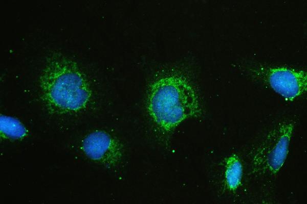 IF analysis of HAS1 using anti-HAS1 antibody (A04784-1). HAS1 was detected in immunocytochemical section of U20S cell. Enzyme antigen retrieval was performed using IHC enzyme antigen retrieval reagent (AR0022) for 15 mins. The cells were blocked with 10% goat serum. And then incubated with 2μg/mL rabbit anti-HAS1 Antibody (A04784-1) overnight at 4°C. DyLight®488 Conjugated Goat Anti-Rabbit IgG (BA1127) was used as secondary antibody at 1:100 dilution and incubated for 30 minutes at 37°C. The section was counterstained with DAPI. Visualize using a fluorescence microscope and filter sets appropriate for the label used.