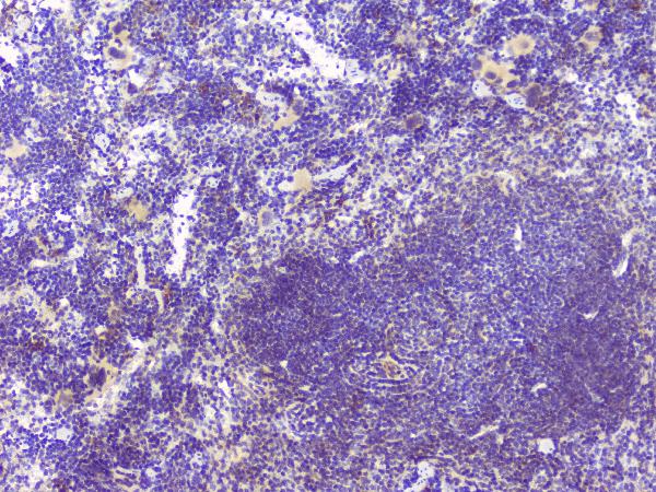 IHC analysis of HAS1 using anti-HAS1 antibody (A04784-1). HAS1 was detected in paraffin-embedded section of mouse spleen tissue. Heat mediated antigen retrieval was performed in citrate buffer (pH6, epitope retrieval solution) for 20 mins. The tissue section was blocked with 10% goat serum. The tissue section was then incubated with 1ugμg/ml rabbit anti-HAS1 Antibody (A04784-1) overnight at 4°C. Biotinylated goat anti-rabbit IgG was used as secondary antibody and incubated for 30 minutes at 37°C. The tissue section was developed using Strepavidin-Biotin-Complex (SABC)(Catalog # SA1022) with DAB as the chromogen.