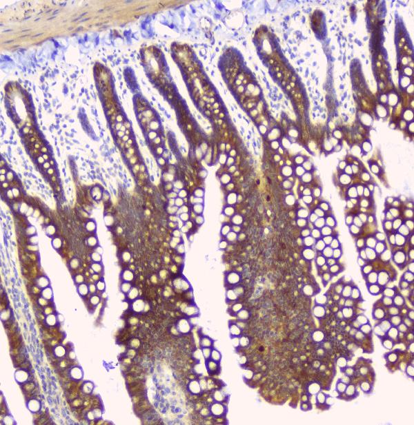 IHC analysis of HAS1 using anti-HAS1 antibody (A04784-1). HAS1 was detected in paraffin-embedded section of rat small intestine tissue. Heat mediated antigen retrieval was performed in citrate buffer (pH6, epitope retrieval solution) for 20 mins. The tissue section was blocked with 10% goat serum. The tissue section was then incubated with 1ugμg/ml rabbit anti-HAS1 Antibody (A04784-1) overnight at 4°C. Biotinylated goat anti-rabbit IgG was used as secondary antibody and incubated for 30 minutes at 37°C. The tissue section was developed using Strepavidin-Biotin-Complex (SABC)(Catalog # SA1022) with DAB as the chromogen.