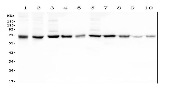 Western blot analysis of HAS1 using anti-HAS1 antibody (A04784-1). Electrophoresis was performed on a 5-20% SDS-PAGE gel at 70V (Stacking gel) / 90V (Resolving gel) for 2-3 hours. The sample well of each lane was loaded with 50ug of sample under reducing conditions. Lane 1: human SHG-44 whole cell lysates, Lane 2: human THP-1 whole cell lysates, Lane 3: rat brain tissue lysates, Lane 4: rat smooth muscle tissue lysates, Lane 5: rat ovary tissue lysates, Lane 6: mouse brain tissue lysates, Lane 7: mouse smooth muscle tissue lysates, Lane 8: mouse ovary tissue lysates, Lane 9: mouse small intestine tissue lysates, Lane 10: mouse Neuro-2a whole cell lysates. After Electrophoresis, proteins were transferred to a Nitrocellulose membrane at 150mA for 50-90 minutes. Blocked the membrane with 5% Non-fat Milk/ TBS for 1.5 hour at RT. The membrane was incubated with rabbit anti-HAS1 antigen affinity purified polyclonal antibody (Catalog # A04784-1) at 0.5 μg/mL overnight at 4°C, then washed with TBS-0.1%Tween 3 times with 5 minutes each and probed with a goat anti-rabbit IgG-HRP secondary antibody at a dilution of 1:10000 for 1.5 hour at RT. The signal is developed using an Enhanced Chemiluminescent detection (ECL) kit (Catalog # EK1002) with Tanon 5200 system. A specific band was detected for HAS1 at approximately 70KD. The expected band size for HAS1 is at 65KD.