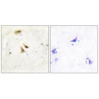 a05134 immunohistochemistry analysis 1