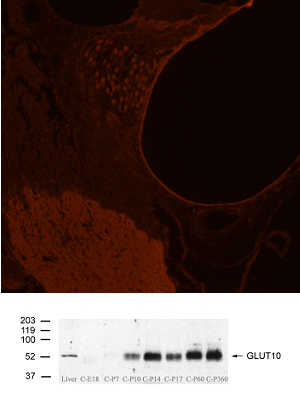 Anti GLUT10 SLC2A10 Antibody