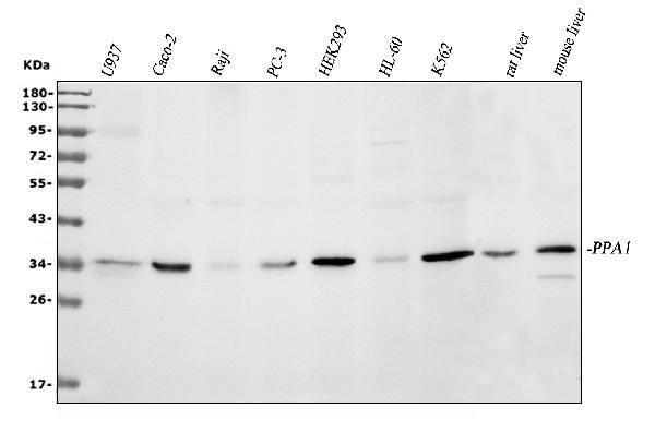 Western blot analysis of PPA1 using anti-PPA1 antibody (A07485-1).