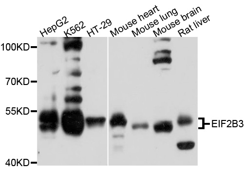 Anti-EIF2B3 Antibody