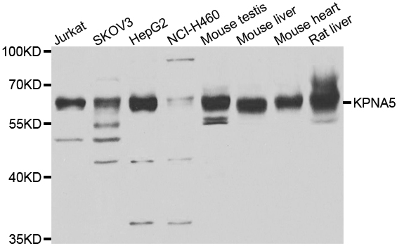 Importin subunit alpha-6 KPNA5 Antibody A09441-2