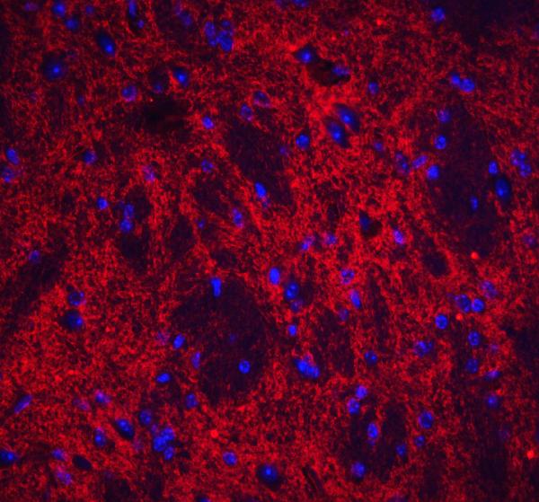 Anti-Neuronal pentraxin-2 NPTX2 Antibody