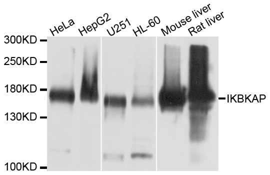 Anti-IKAP ELP1 Antibody