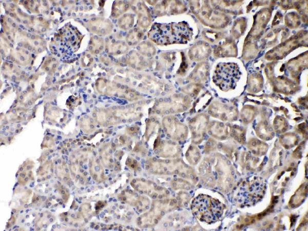 IHC analysis of PNP using anti-PNP antibody (A00988-1). PNP was detected in paraffin-embedded section of mouse kidney tissues. Heat mediated antigen retrieval was performed in citrate buffer (pH6, epitope retrieval solution) for 20 mins. The tissue section was blocked with 10% goat serum. The tissue section was then incubated with 1μg/ml rabbit anti-PNP Antibody (A00988-1) overnight at 4°C. Biotinylated goat anti-rabbit IgG was used as secondary antibody and incubated for 30 minutes at 37°C. The tissue section was developed using Strepavidin-Biotin-Complex (SABC)(Catalog # SA1022) with DAB as the chromogen.