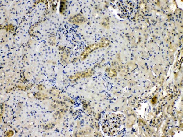 IHC analysis of PNP using anti-PNP antibody (A00988-1). PNP was detected in paraffin-embedded section of rat kidney tissues. Heat mediated antigen retrieval was performed in citrate buffer (pH6, epitope retrieval solution) for 20 mins. The tissue section was blocked with 10% goat serum. The tissue section was then incubated with 1μg/ml rabbit anti-PNP Antibody (A00988-1) overnight at 4°C. Biotinylated goat anti-rabbit IgG was used as secondary antibody and incubated for 30 minutes at 37°C. The tissue section was developed using Strepavidin-Biotin-Complex (SABC)(Catalog # SA1022) with DAB as the chromogen.