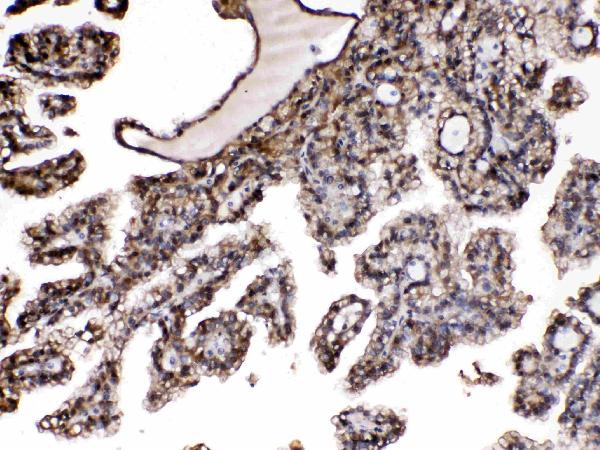 IHC analysis of PNP using anti-PNP antibody (A00988-1).