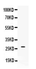 Western blot analysis of VEGF using anti-VEGF antibody (A00045).