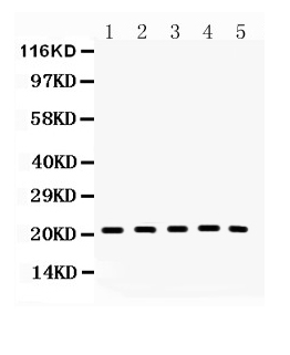 Western blot analysis of Bax using anti-Bax antibody (A00183). Electrophoresis was performed on a 5-20% SDS-PAGE gel at 70V (Stacking gel) / 90V (Resolving gel) for 2-3 hours. The sample well of each lane was loaded with 50ug of sample under reducing conditions. Lane 1: rat thymus tissue lysates, Lane 2: mouse thymus tissue lysates, Lane 3: HEPA1-6 whole cell lysates, Lane 4: HELA whole cell lysates, Lane 5: MCF-7 whole cell lysates. After Electrophoresis, proteins were transferred to a Nitrocellulose membrane at 150mA for 50-90 minutes. Blocked the membrane with 5% Non-fat Milk/ TBS for 1.5 hour at RT. The membrane was incubated with rabbit anti-Bax antigen affinity purified polyclonal antibody (Catalog # A00183) at 0.5 μg/mL overnight at 4°C, then washed with TBS-0.1%Tween 3 times with 5 minutes each and probed with a goat anti-rabbit IgG-HRP secondary antibody at a dilution of 1:10000 for 1.5 hour at RT. The signal is developed using an Enhanced Chemiluminescent detection (ECL) kit (Catalog # EK1002) with Tanon 5200 system. A specific band was detected for Bax at approximately 21KD. The expected band size for Bax is at 21KD.