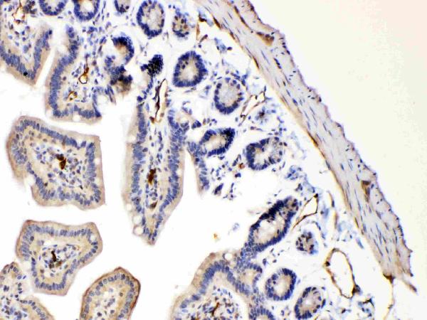 IHC analysis of Bax using anti-Bax antibody (A00183). Bax was detected in paraffin-embedded section of mouse intestine tissues. Heat mediated antigen retrieval was performed in citrate buffer (pH6, epitope retrieval solution) for 20 mins. The tissue section was blocked with 10% goat serum. The tissue section was then incubated with 1μg/ml rabbit anti-Bax Antibody (A00183) overnight at 4°C. Biotinylated goat anti-rabbit IgG was used as secondary antibody and incubated for 30 minutes at 37°C. The tissue section was developed using Strepavidin-Biotin-Complex (SABC)(Catalog # SA1022) with DAB as the chromogen.