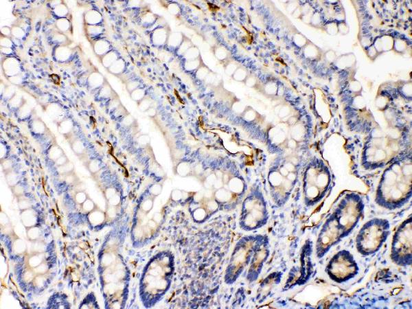 IHC analysis of Bax using anti-Bax antibody (A00183). Bax was detected in paraffin-embedded section of rat intestine tissues. Heat mediated antigen retrieval was performed in citrate buffer (pH6, epitope retrieval solution) for 20 mins. The tissue section was blocked with 10% goat serum. The tissue section was then incubated with 1μg/ml rabbit anti-Bax Antibody (A00183) overnight at 4°C. Biotinylated goat anti-rabbit IgG was used as secondary antibody and incubated for 30 minutes at 37°C. The tissue section was developed using Strepavidin-Biotin-Complex (SABC)(Catalog # SA1022) with DAB as the chromogen.